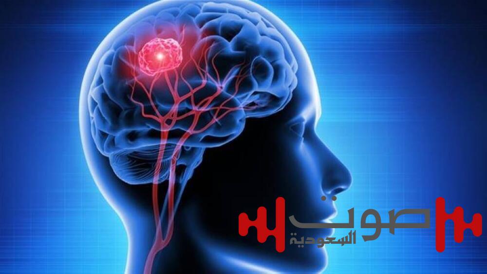 فنانة هوليوود تواجه الموت.. تشارلي تتحدى أخطر ورم دماغي!