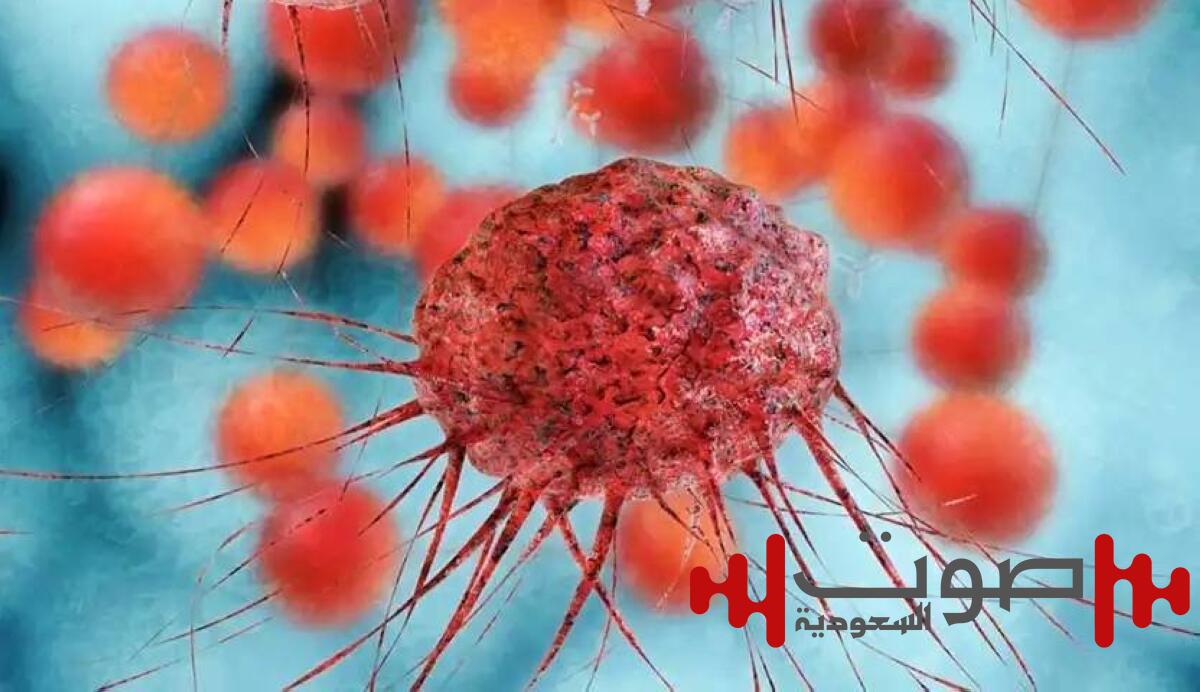 علاج واعد لأحد أخطر أنواع سرطان الدم