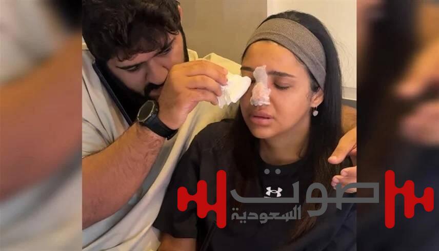 بلوغر مصرية كادت تفقد أنفها وبصرها بسبب «حقنة فيلر»