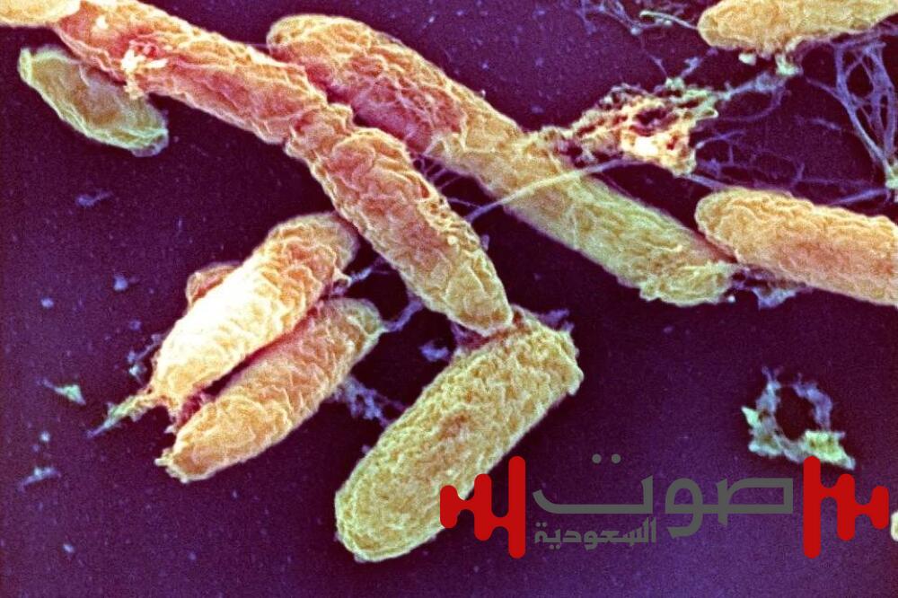 بعد 24 ساعة من ظهور الأعراض.. وفاة شخص في أريزونا بسبب «الطاعون»