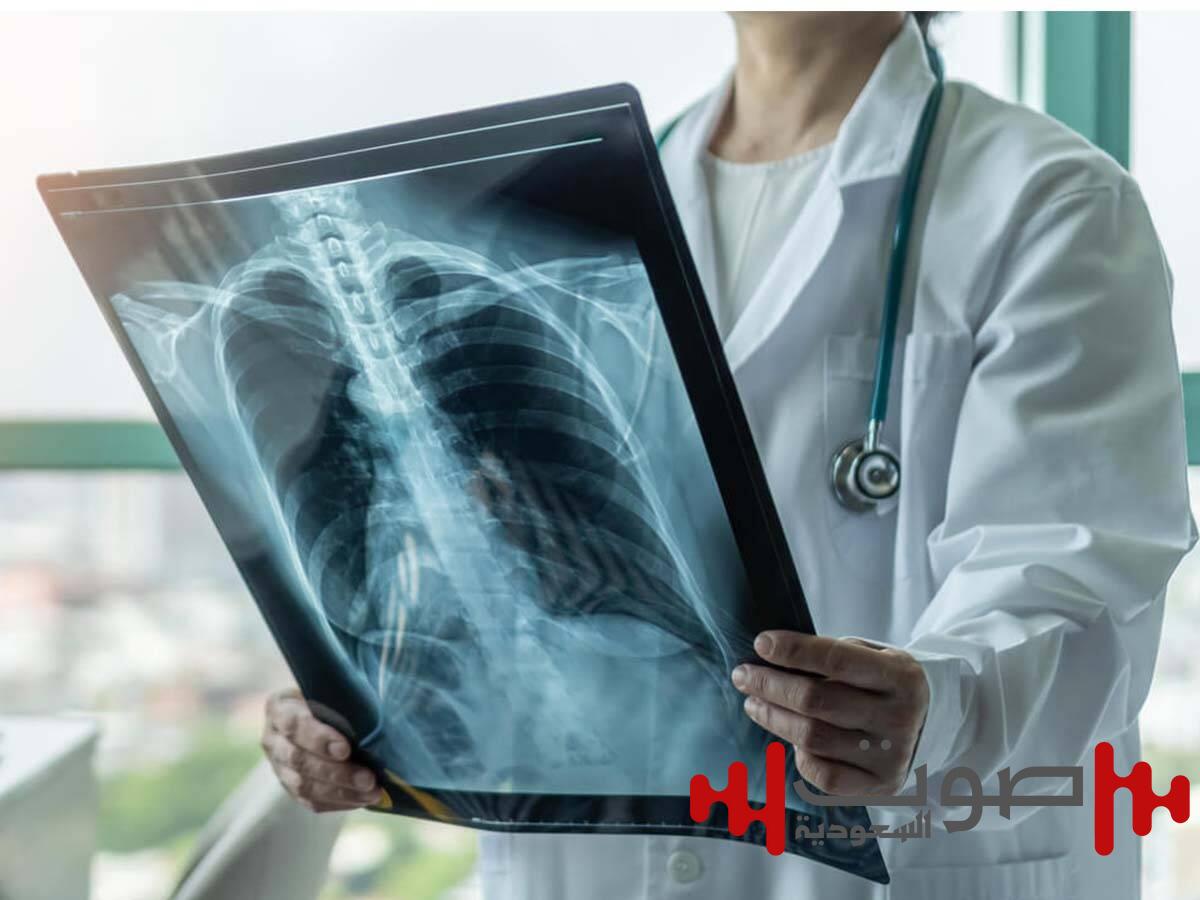 علماء روس يبتكرون جهاز أشعة سينية بحجم الهاتف الذكي