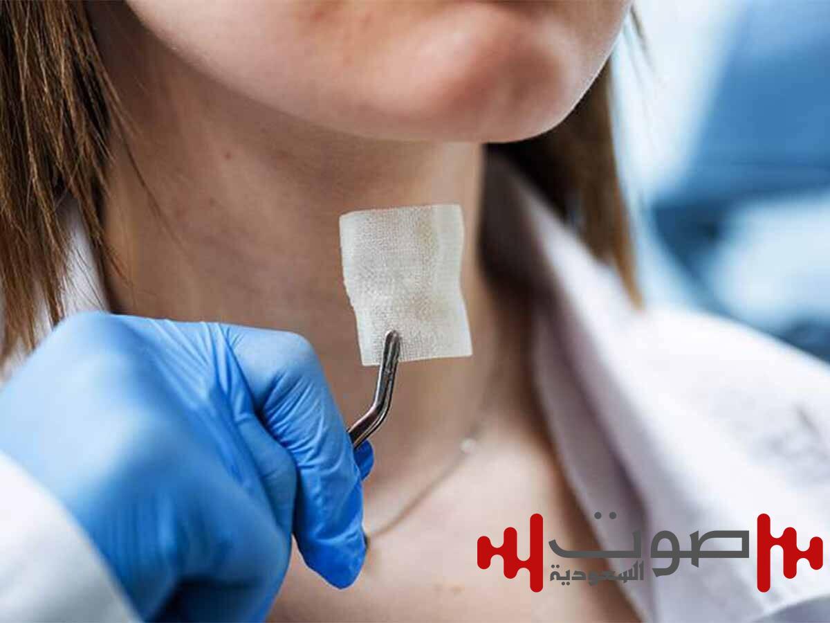 تجديد حنجرة مريض السرطان بطابعة ثلاثية الأبعاد
