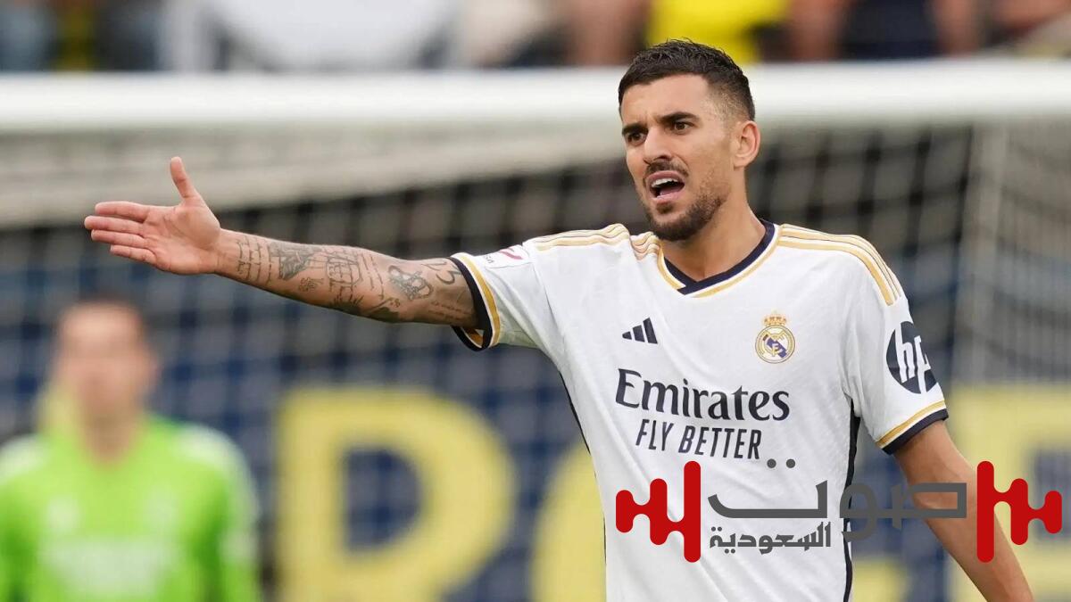 سيبايوس حائر بين 3 خيارات