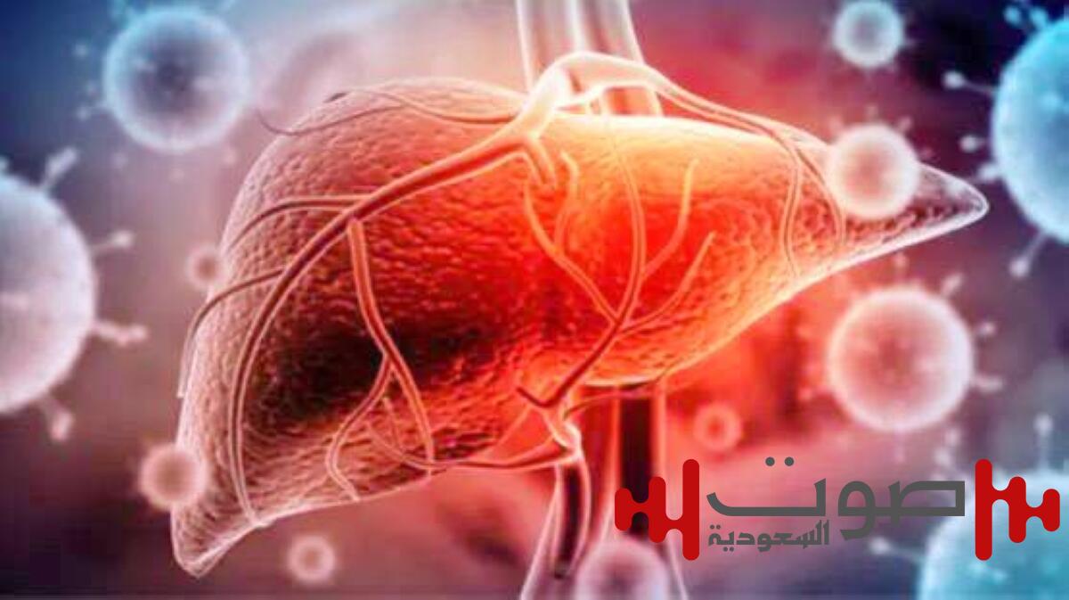 دهون الكبد.. خطر صامت بلا أعراض واضحة